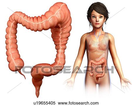 Stock Photography - Human megacolon, illustration. Fotosearch