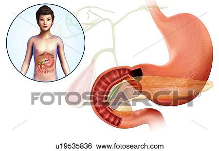 Human stomach anatomy, illustration View Large Photo Image Stock Photograph - Human stomach anatomy, illustration. Fotosearch