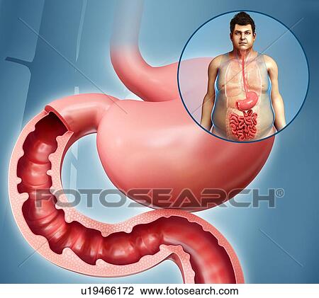 Human stomach, illustration View Large Photo Image Stock Image - Human stomach, illustration. Fotosearch