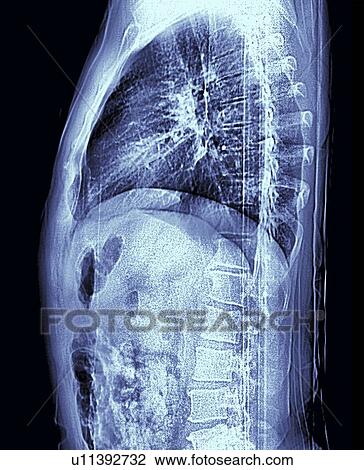 Human torso, MRI scan View Large Photo Image Stock Image - Human torso, MRI scan. Fotosearch