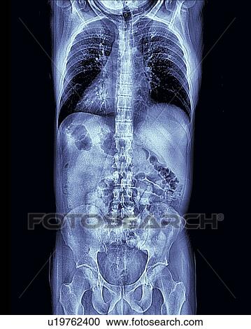 Human torso, MRI scan View Large Photo Image Stock Image - Human torso, MRI scan. Fotosearch
