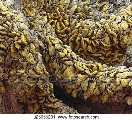 Stock Image - Intestinal villi, SEM. Fotosearch