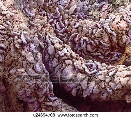 Stock Photo - Intestinal villi, SEM. Fotosearch