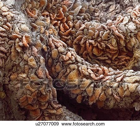 Stock Photo - Intestinal villi, SEM. Fotosearch
