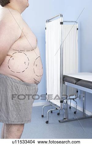 Liposuction View Large Photo Image Picture - Liposuction. Fotosearch