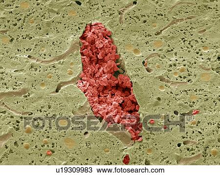 Stock Image - Liver vein, SEM. Fotosearch