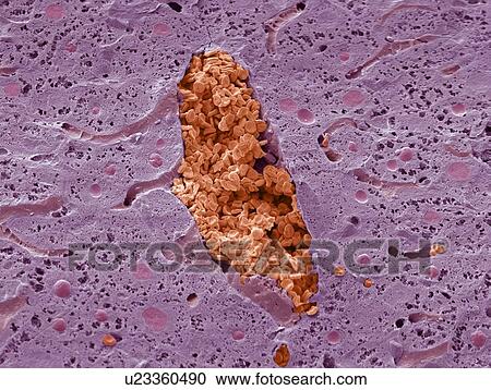 Stock Image - Liver vein, SEM. Fotosearch
