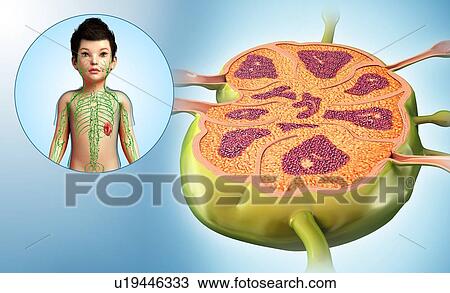 Stock Image - Lymph node of a child, illustration. Fotosearch