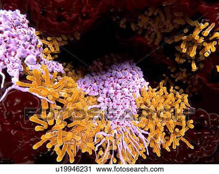 Stock Image - Macrophages in tuberculosis, illustration. Fotosearch
