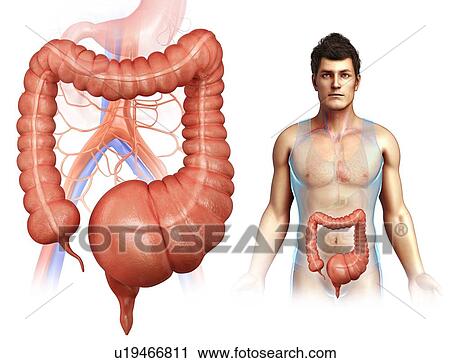 Stock Image - Mega colon, illustration. Fotosearch