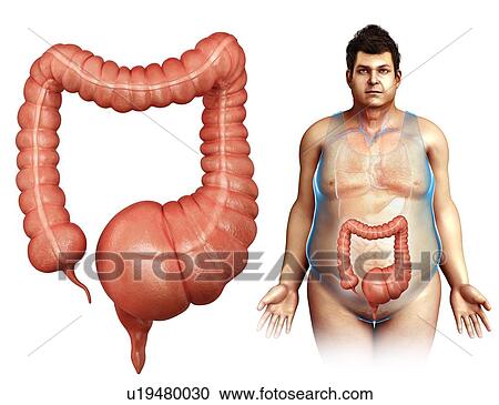 Mega colon, illustration View Large Photo Image Stock Image - Mega colon, illustration. Fotosearch