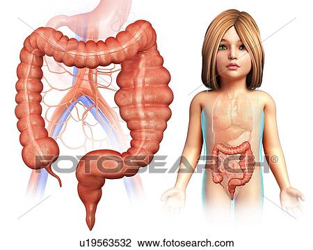 Stock Image - Mega colon of a child, illustration. Fotosearch