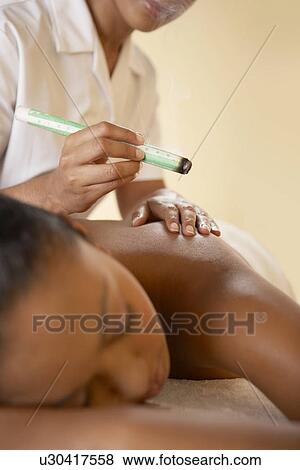 Moxibustion View Large Photo Image Stock Photo - Moxibustion. Fotosearch