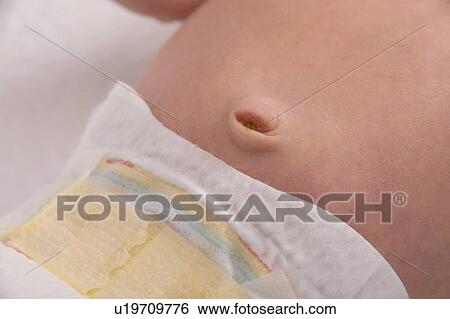 Stock Photograph - Newborn baby's navel. Fotosearch