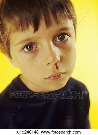 Nosebleed View Large Photo Image Stock Photo - Nosebleed. Fotosearch