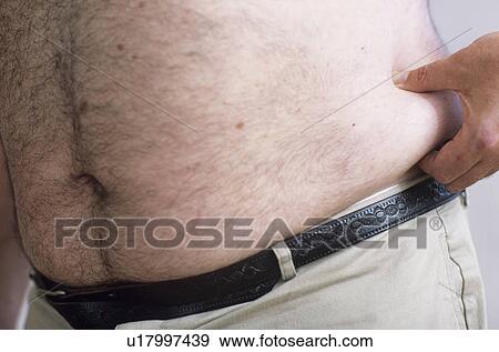 Obesity View Large Photo Image Stock Photo - Obesity. Fotosearch