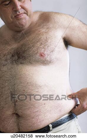 Stock Photo - Obesity. Fotosearch