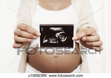Pregnant woman holding her baby scan View Large Photo Image Stock Photo - Pregnant woman holding her baby scan. Fotosearch