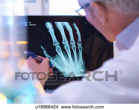 Picture - Radiographer looking at x-ray of hand fracture. Fotosearch