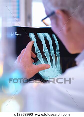 Stock Image - Radiographer looking at x-ray of hand fracture. Fotosearch