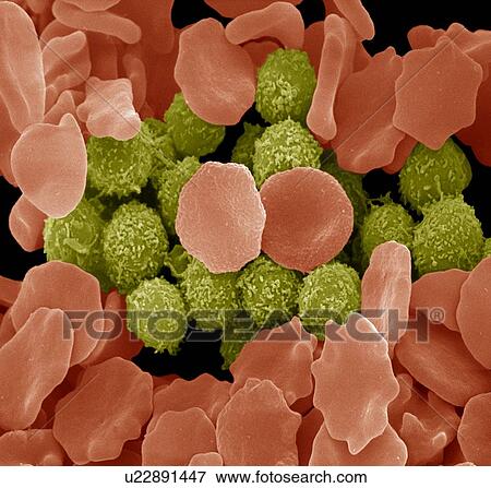 Stock Photo - Red and white blood cells, SEM. Fotosearch