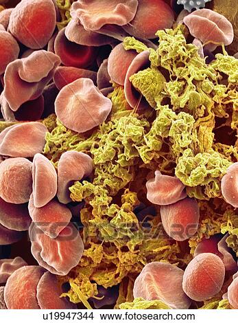 Red blood cells and platelets, SEM View Large Photo Image Picture - Red blood cells and platelets, SEM. Fotosearch