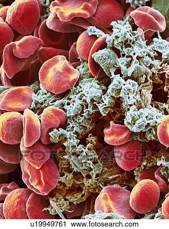 Red blood cells and platelets, SEM View Large Photo Image Stock Image - Red blood cells and platelets, SEM. Fotosearch