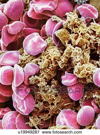 Red blood cells and platelets, SEM View Large Photo Image Stock Photo - Red blood cells and platelets, SEM. Fotosearch