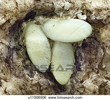 Stock Photograph - Sarcoptic mange mite eggs, SEM. Fotosearch