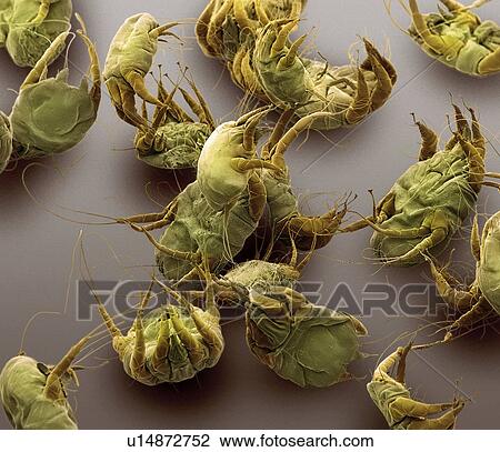 Stock Image - Sarcoptic mange mites, SEM. Fotosearch