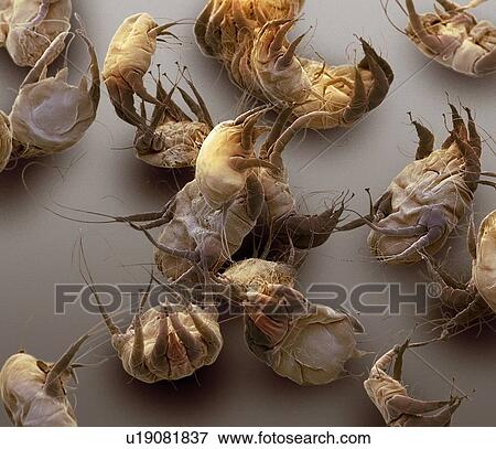 Stock Photo - Sarcoptic mange mites, SEM. Fotosearch