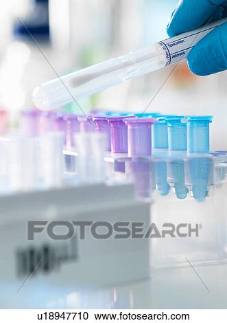 Stock Image - Scientist preparing a DNA swab for analysis in a laboratory for forensic or paternity testing. Fotosearch