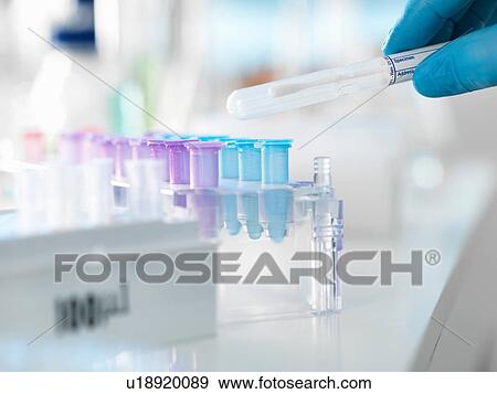 Stock Photo - Scientist preparing a DNA swab for analysis in a laboratory for forensic or paternity testing. Fotosearch