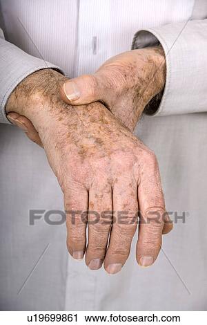 Stock Image - Senior man holding his wrist. Fotosearch