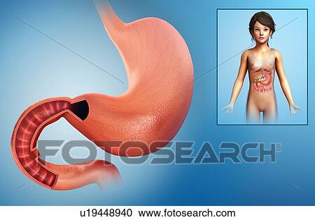 Stomach of a child, illustration View Large Photo Image Stock Image - Stomach of a child, illustration. Fotosearch