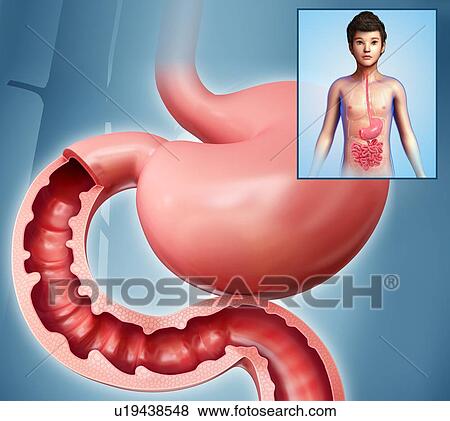 Stock Photo - Stomach of a child, illustration. Fotosearch