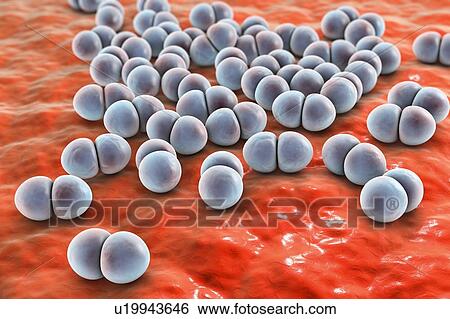 Stock Photograph - Streptococcus pneumoniae, illustration. Fotosearch