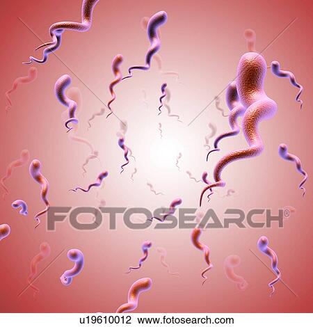 Stock Image - Syphilis bacteria, illustration. Fotosearch