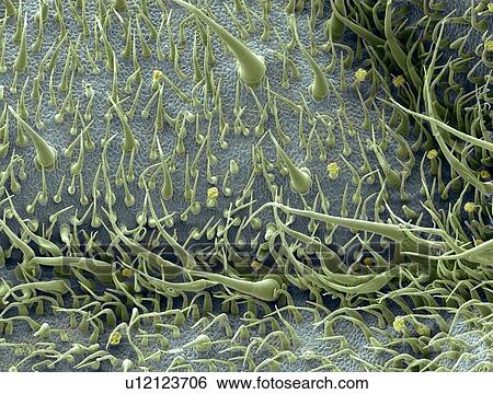 Stock Photograph - Tomato leaf surface, SEM. Fotosearch