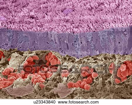 Trachea mucous membrane, SEM View Large Photo Image Stock Image - Trachea mucous membrane, SEM. Fotosearch