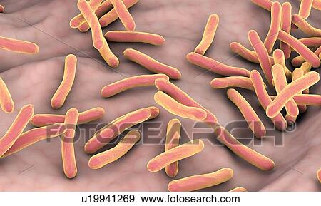 Tuberculosis bacteria, illustration View Large Photo Image Stock Photo - Tuberculosis bacteria, illustration. Fotosearch