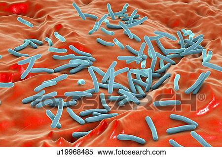 Tuberculosis bacteria, illustration View Large Photo Image Stock Photography - Tuberculosis bacteria, illustration. Fotosearch