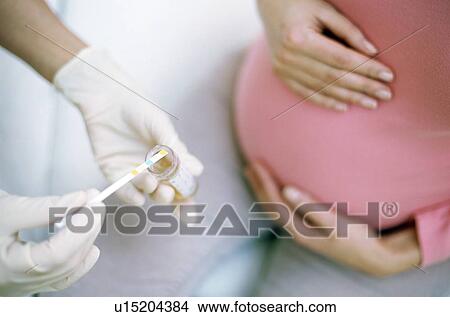Urine analysis in pregnancy View Large Photo Image Picture - Urine analysis in pregnancy. Fotosearch