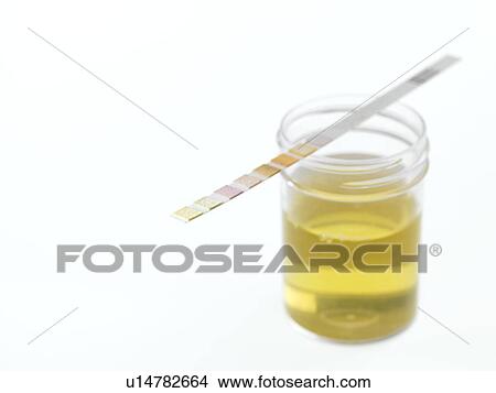Urine analysis View Large Photo Image Picture - Urine analysis. Fotosearch