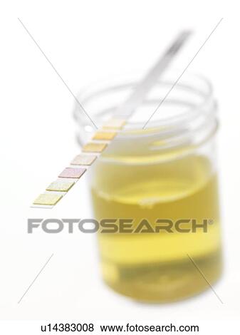 Urine analysis View Large Photo Image Stock Photo - Urine analysis. Fotosearch