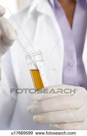 Stock Photo - Urine sample analysis. Fotosearch