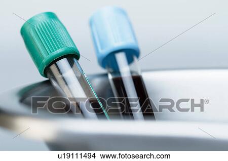 Picture - Vials of blood in kidney dish. Fotosearch