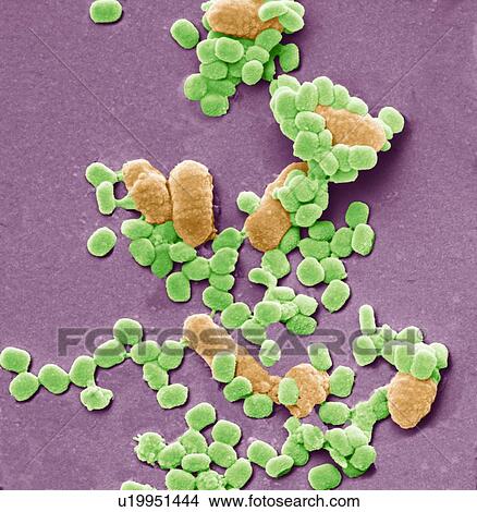 Virus particles and bacteria, SEM View Large Photo Image Picture - Virus particles and bacteria, SEM. Fotosearch