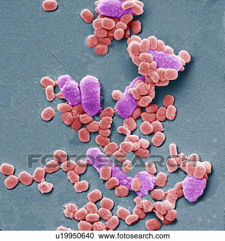 Virus particles and bacteria, SEM View Large Photo Image Stock Image - Virus particles and bacteria, SEM. Fotosearch