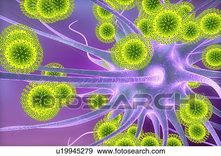 Stock Photo - Zika virus infecting neuron, illustration. Fotosearch